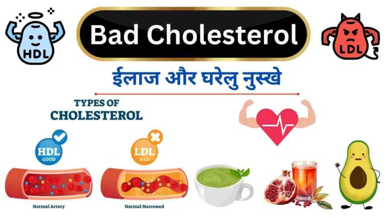 bad cholesterol kam karne ka ilaj diet tips Hindi