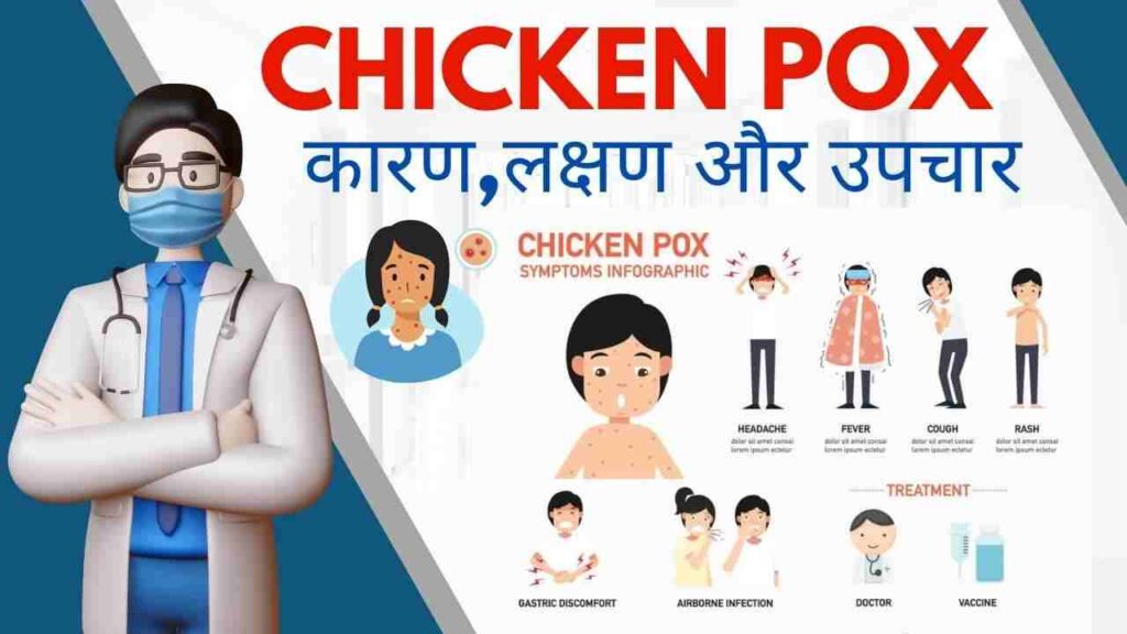 Chicken Pox का कारण, लक्षण और उपचार Hindi में