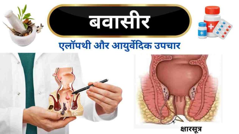 bavasir ka ilaj