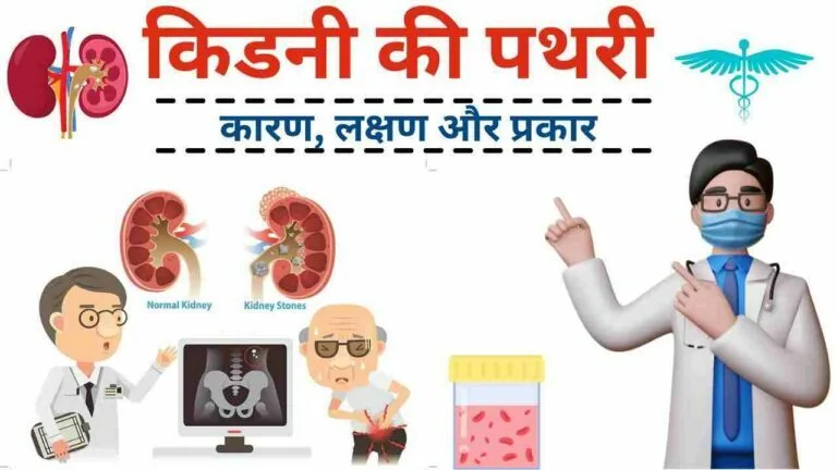 किडनी की पथरी (Kidney Stone) के कारण, लक्षण और प्रकार