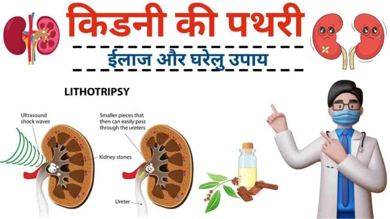 kidney stone ka ilaj aur gharelu ayurveda nuskhe
