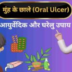 Oral ulcer ayurveda home remedies in Hindi