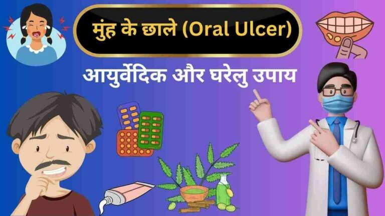 Oral ulcer ayurveda home remedies in Hindi