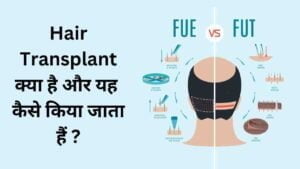 Hair transplant kaise hota hai
