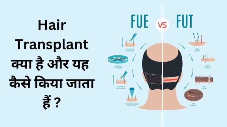 Hair transplant kaise hota hai