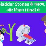 gall bladder stone causes, symptoms and diagnosis in Hindi