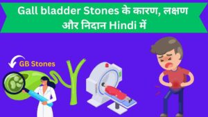gall bladder stone causes, symptoms and diagnosis in Hindi
