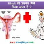 fibroid-treatment-upchar-yoga-in-hindi
