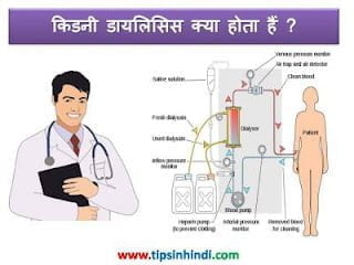 dialysis-information-in-hindi