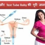 ivf-test-tube-baby-in-hindi-full-information