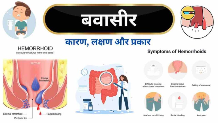 Bavasir ka lakshan kya hai