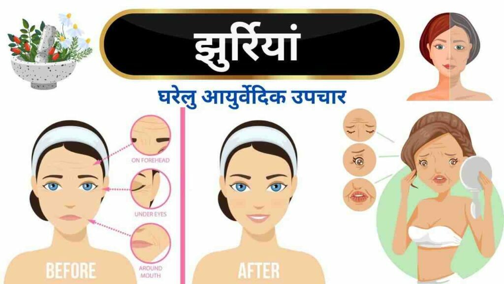 Home remedies for Wrinkles in Hindi