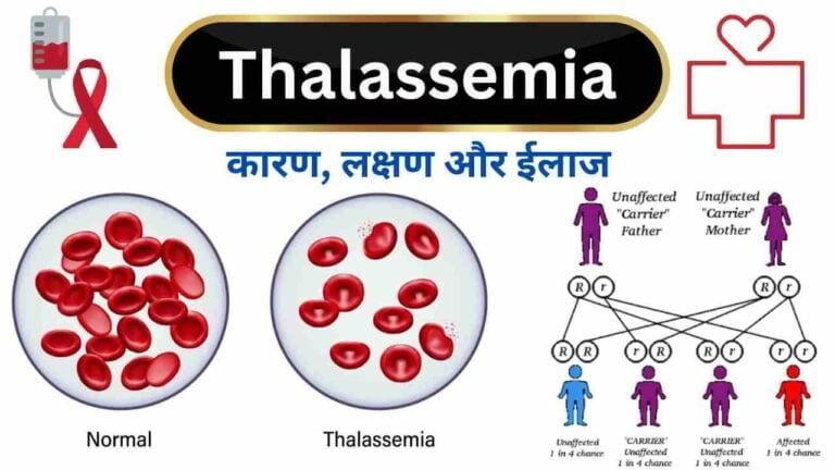 Thalassemia का कारण, लक्षण, निदान, एहतियात और ईलाज