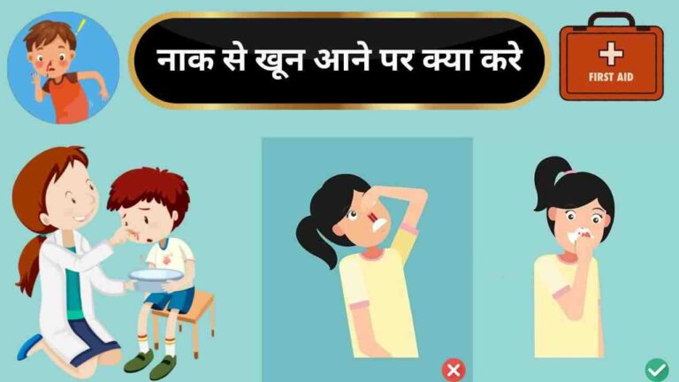 nose bleeding first aid in Hindi