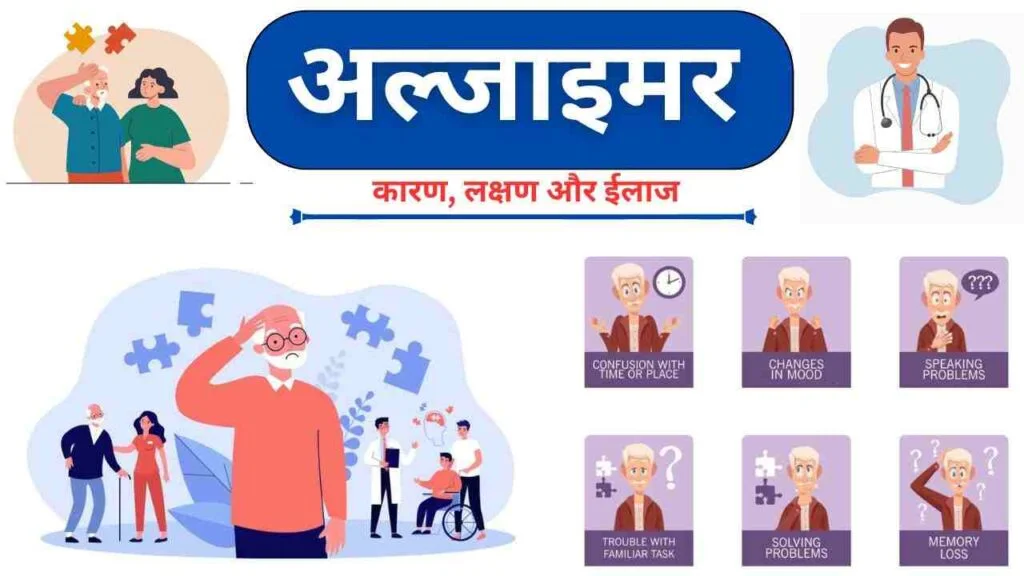 Alzheimers causes symptoms treatment in Hindi