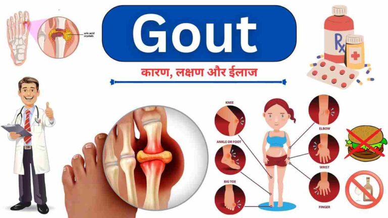 Gout causes symptoms treatment diet in Hindi