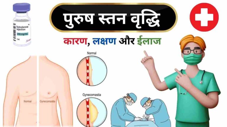 Gynecomastia causes treatment exercise in Hindi