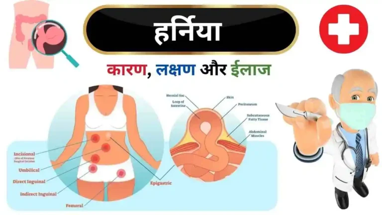 Hernia causes symptoms treatment surgery in Hindi