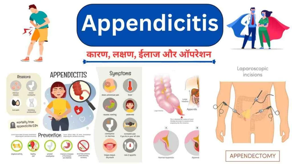 appendicitis symptoms treatment in Hindi language