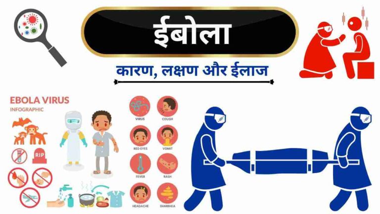 ebola causes symptoms treatment in Hindi