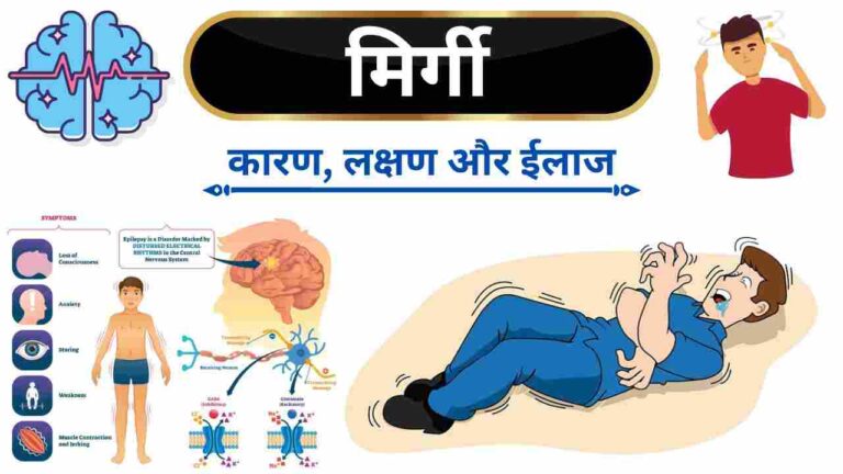 epilepsy causes symptoms treatment in Hindi