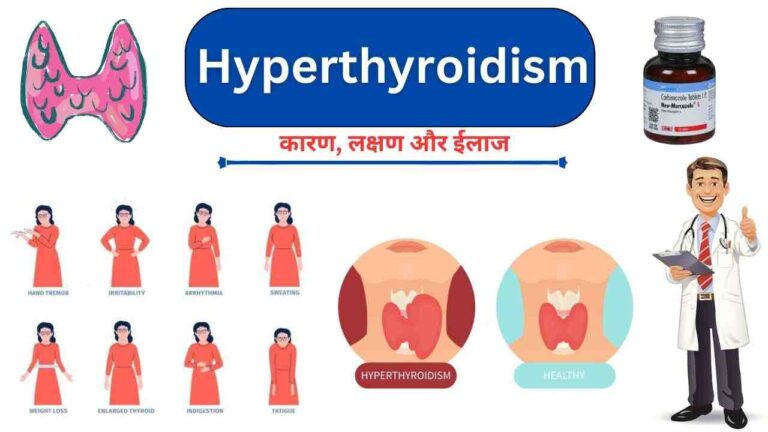 hyperthyroidism causes symptoms treatment in Hindi