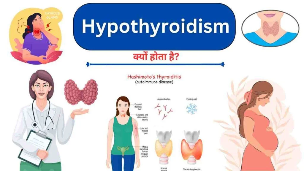 hypothyroidism causes in Hindi
