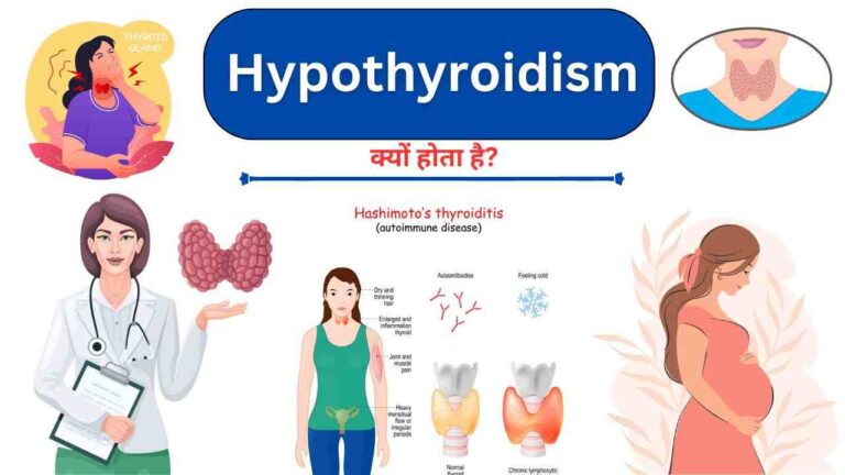 hypothyroidism causes treatment in Hindi
