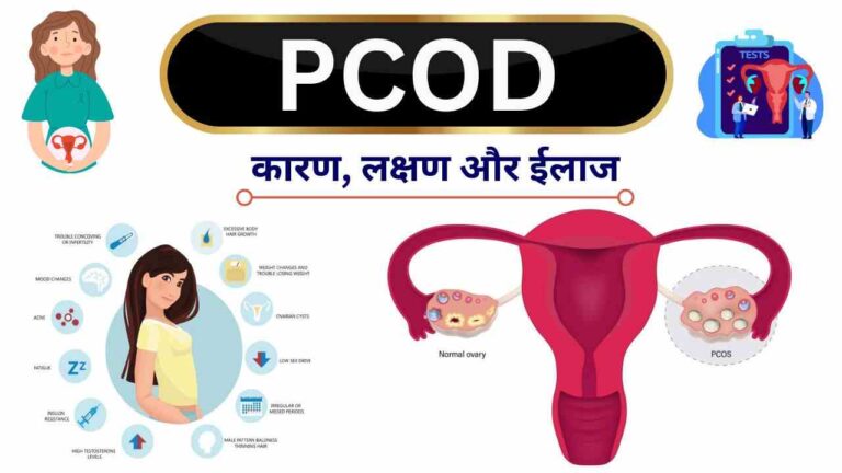 pcod causes symptoms treatment in Hindi
