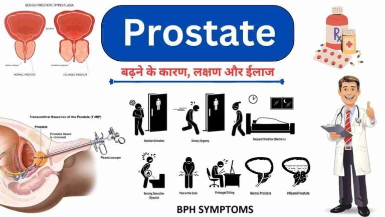 BPH causes, symptoms, treatment and home remedies in Hindi