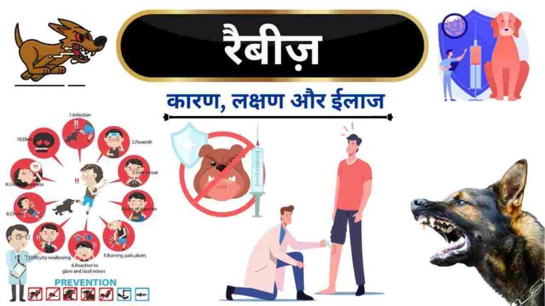 rabies causes symptoms treatment vaccine in Hindi