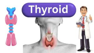 thyroid question answers in Hindi