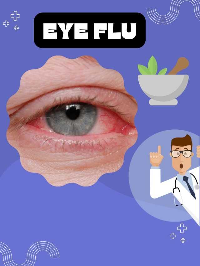 EYE FLU से छुटकारा पाने के 7 ज़बरदस्त घरेलू आयुर्वेदिक उपाय