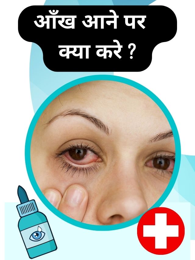 बारिश के मौसम में आँख आने पर क्या करे ?