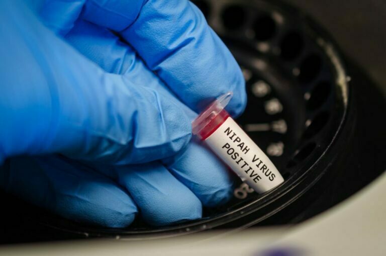 nipah virus symptom treatment in Hindi