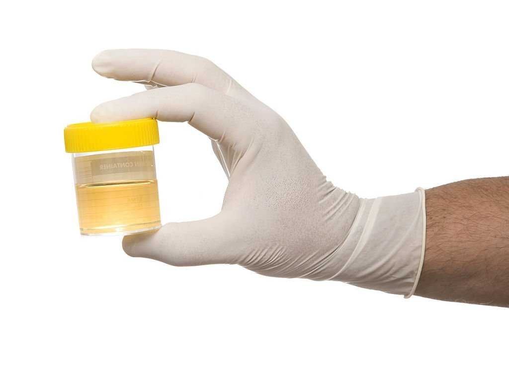 urine routine test in Hindi