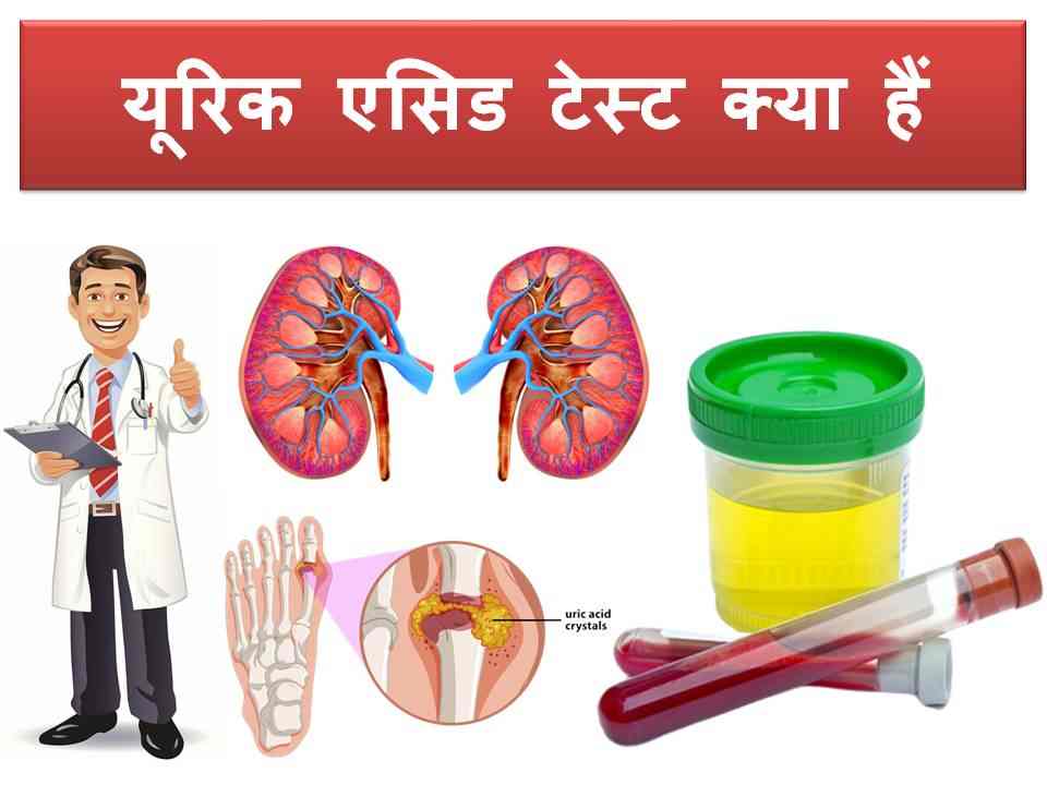Uric acid blood urine test in Hindi
