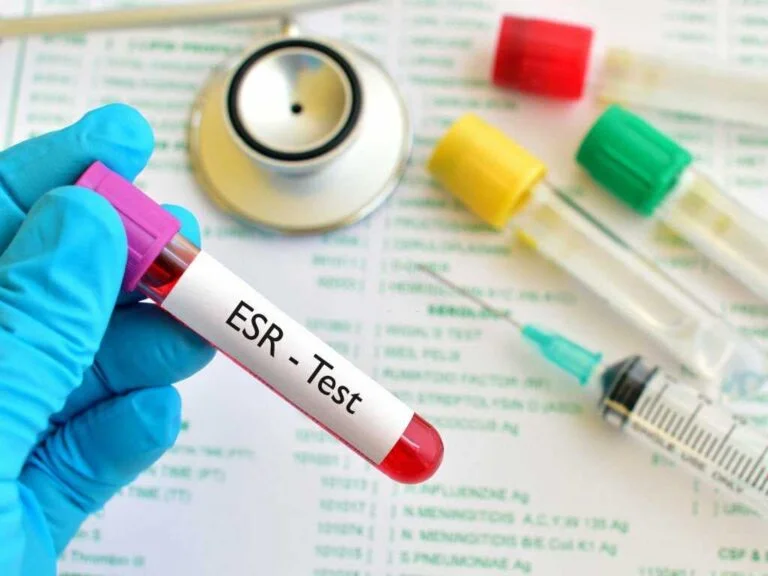 ESR test in Hindi