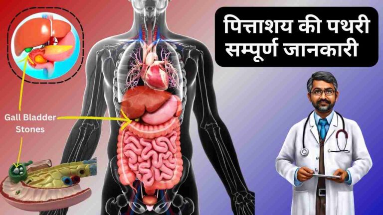 Gall-Bladder-Stones-in-Hindi