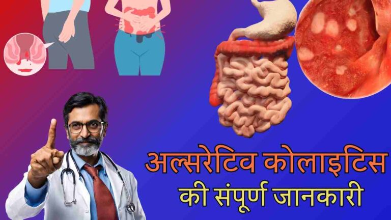 ulcerative colitis causes symptoms treatment diet yoga in Hindi