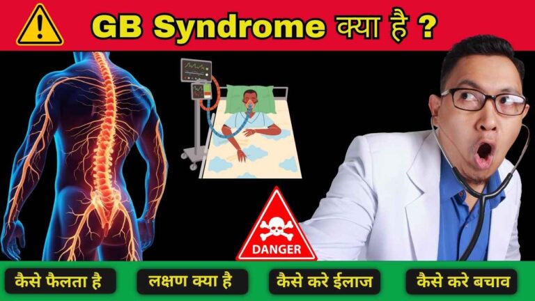 gbs symptoms treatment hindi
